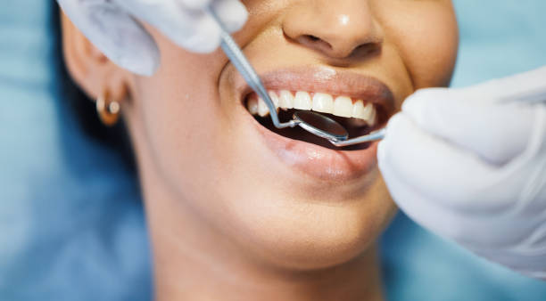Best Emergency Treatment for Oral Infections in Glenmont, MD